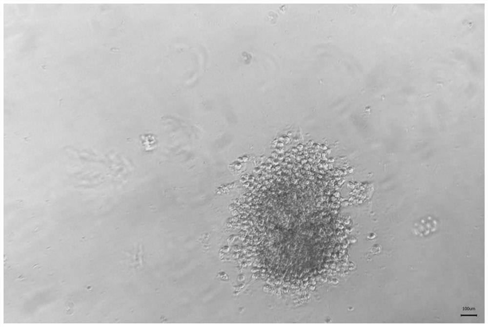 Pancreatic islet in-vitro culture surface parenchyma cell treatment method