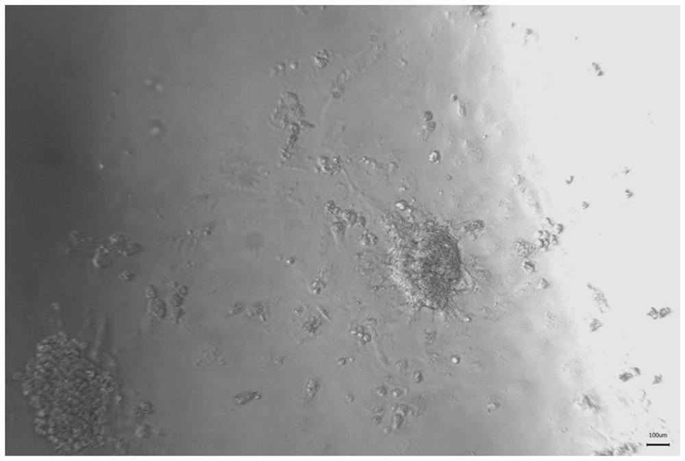 Pancreatic islet in-vitro culture surface parenchyma cell treatment method