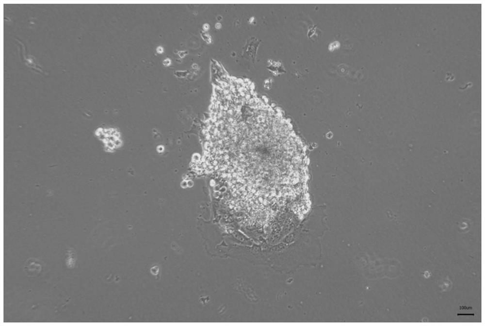 Pancreatic islet in-vitro culture surface parenchyma cell treatment method