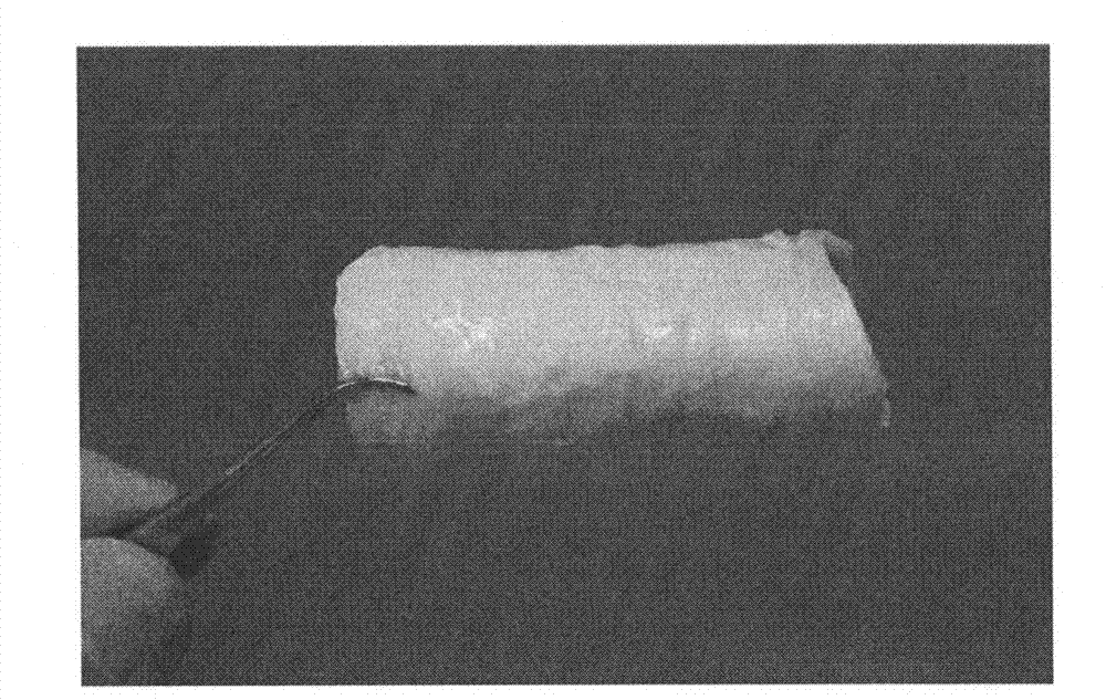 Preparation method of trachea substitute