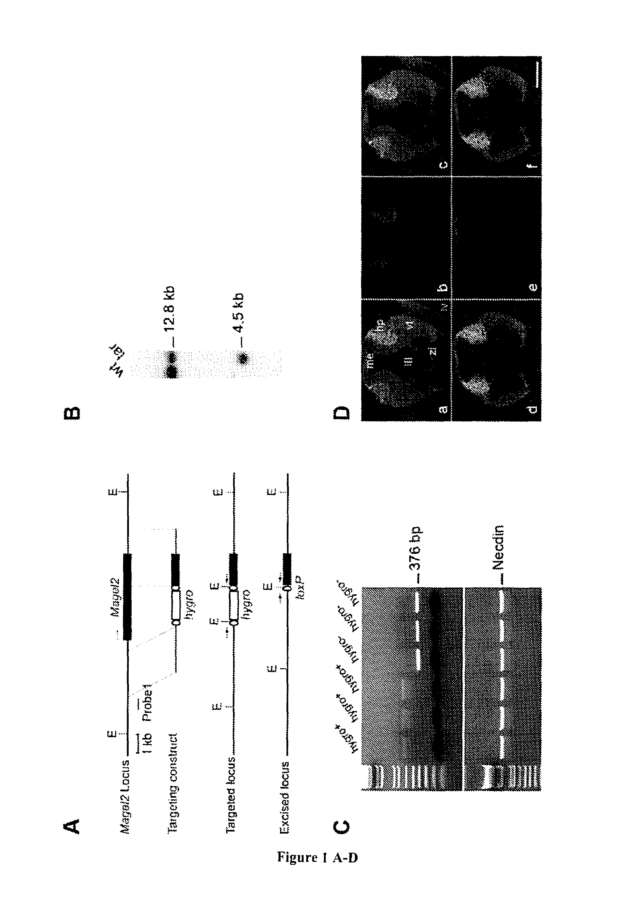 Methods for the treatment of a feeding disorder with onset during neonate development using an agonist of the oxytocin receptor