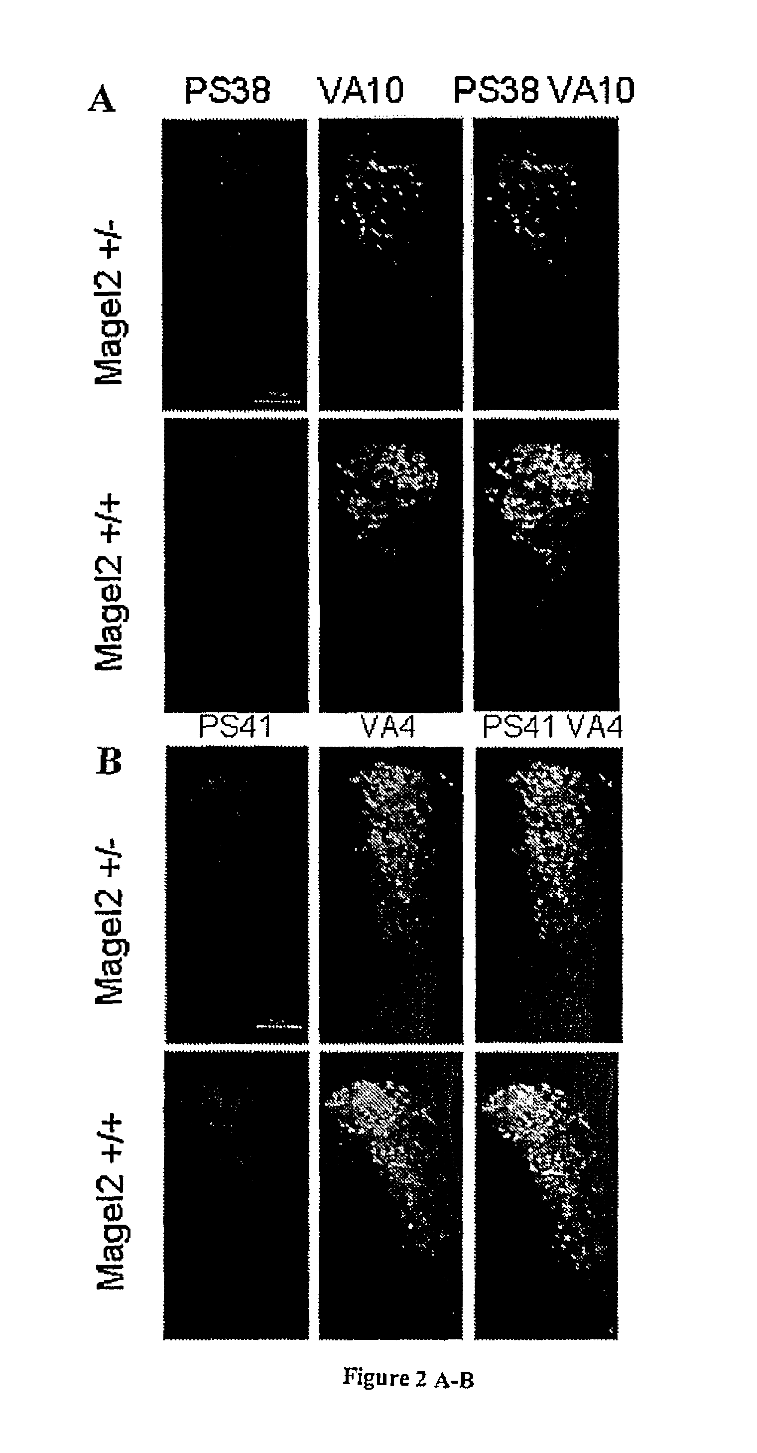 Methods for the treatment of a feeding disorder with onset during neonate development using an agonist of the oxytocin receptor
