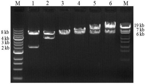 Anthropogenic lysozyme encoding gene and expressing method and application thereof in pichia pastoris