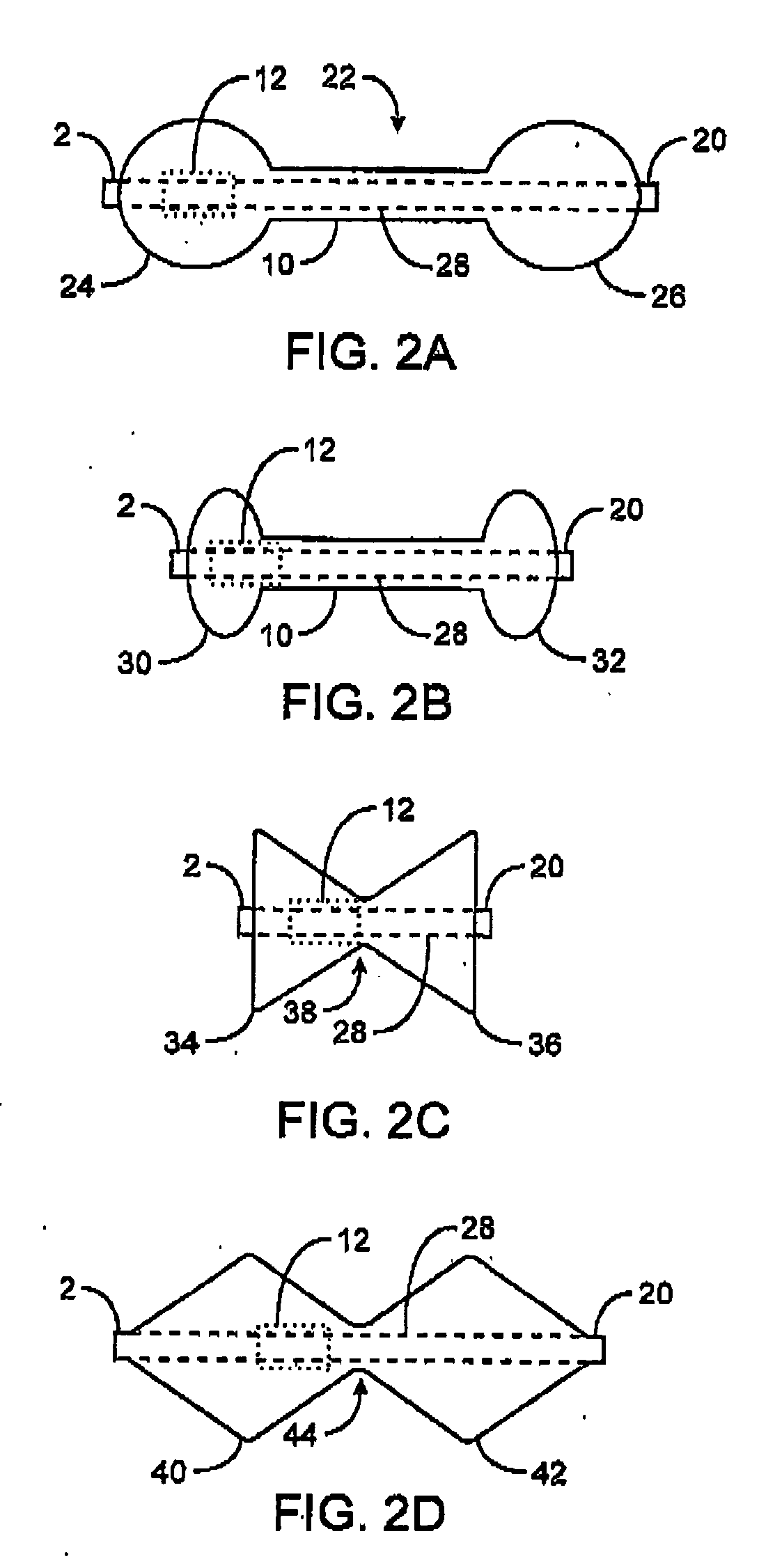 Devices and methods for pyloric anchoring