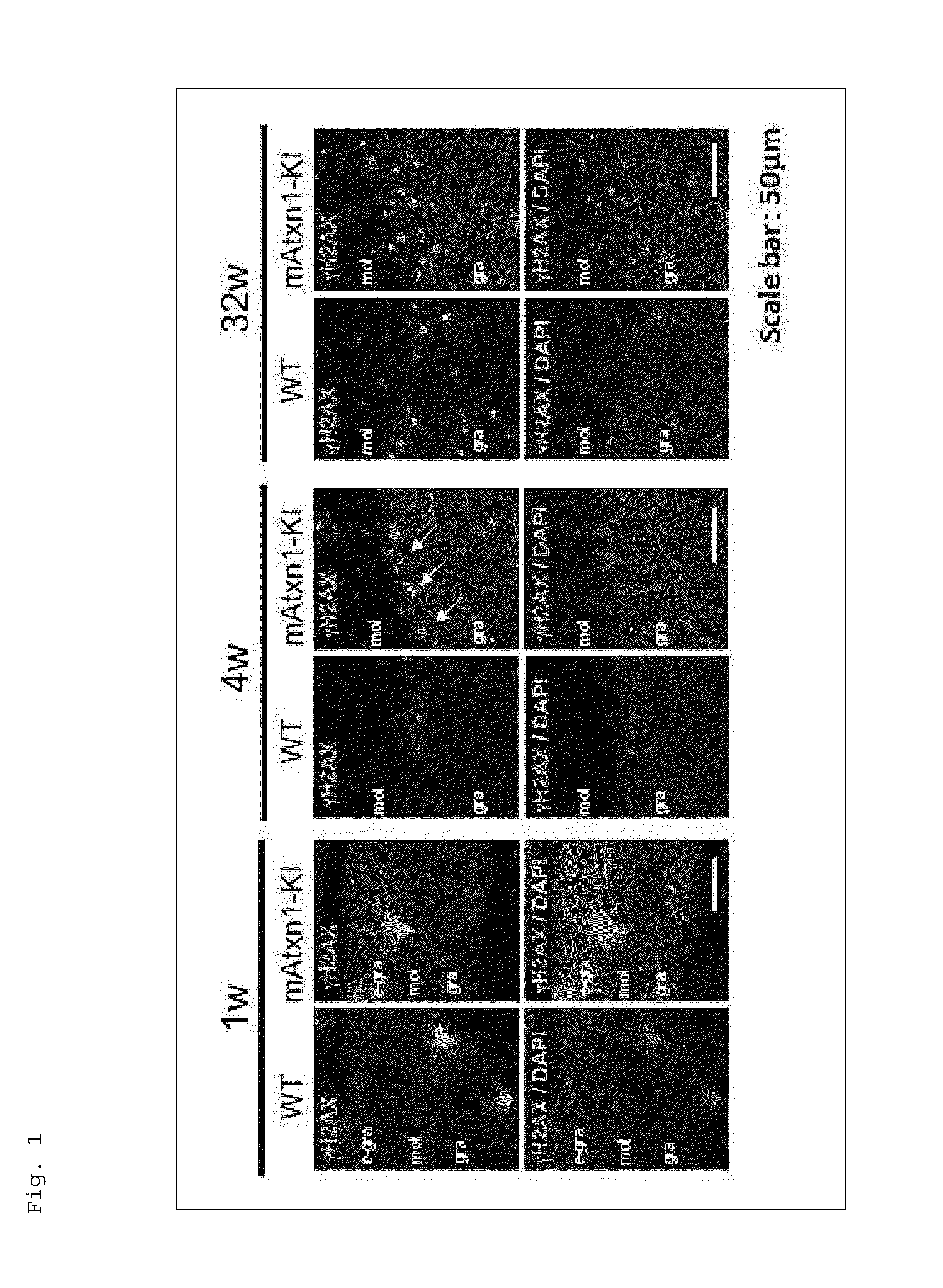 Agent for preventing or treating spinocerebellar ataxia