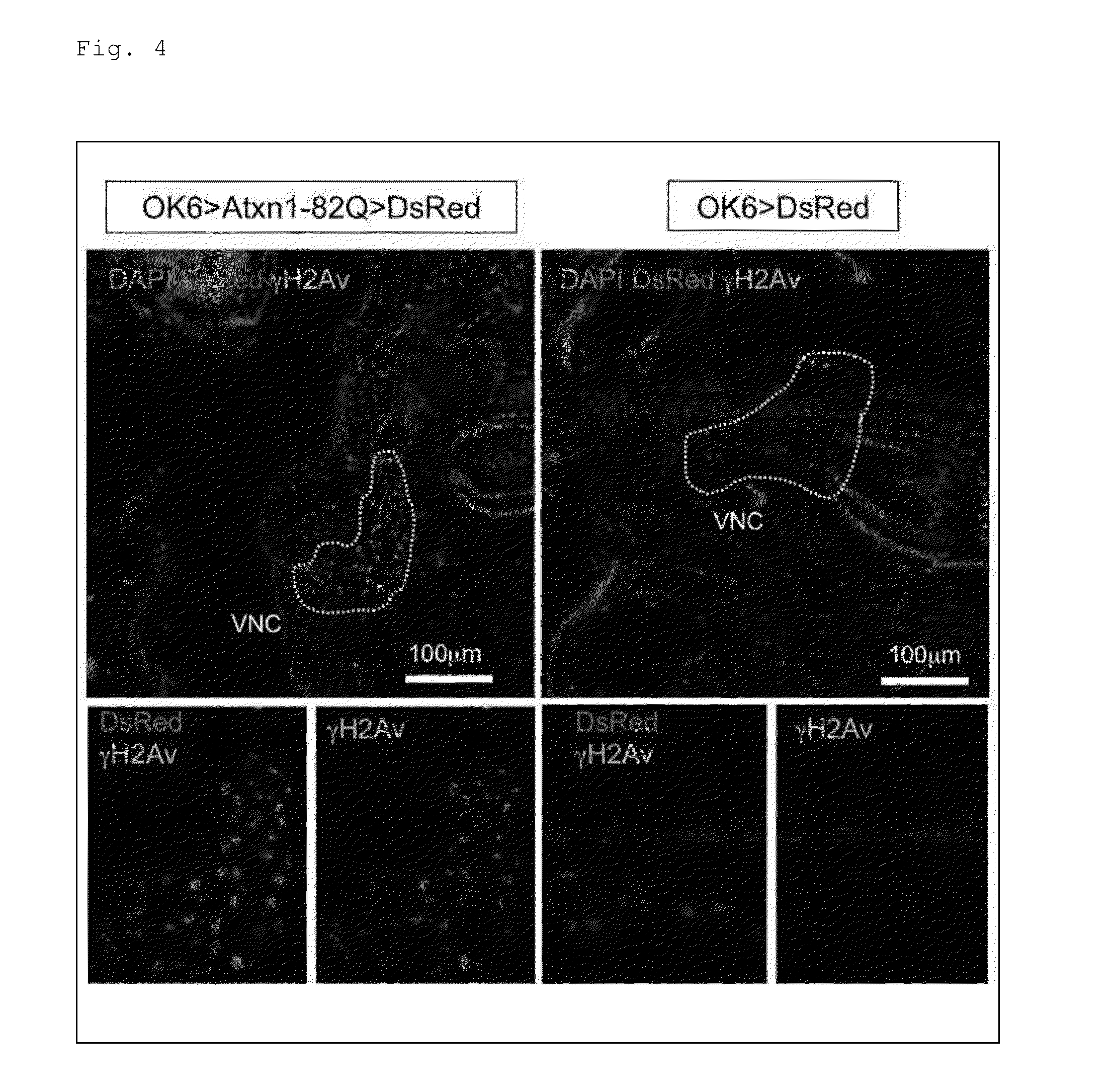 Agent for preventing or treating spinocerebellar ataxia