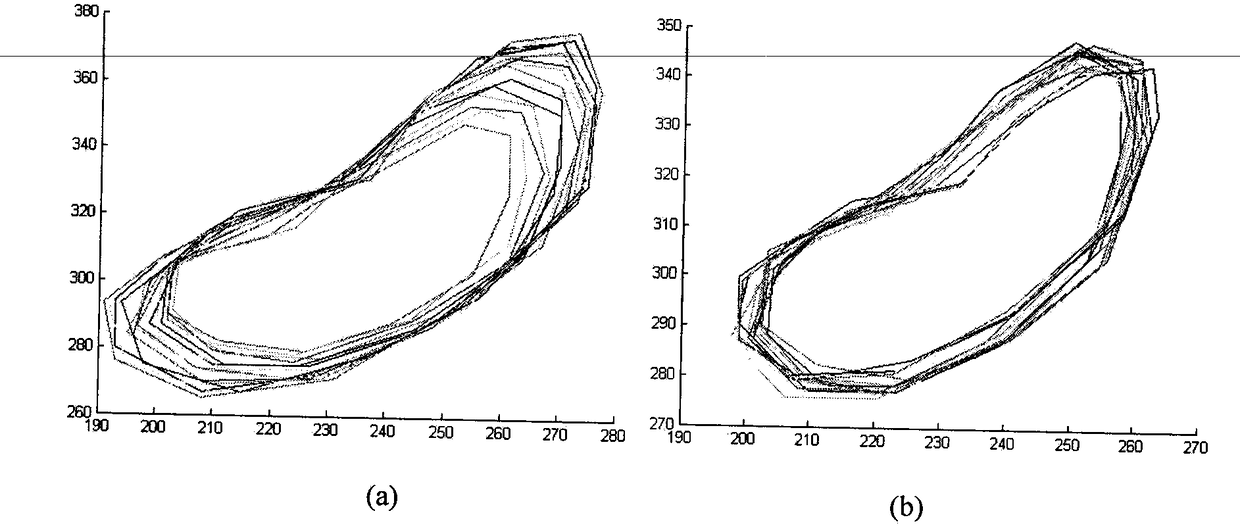 An aortic contour segmentation algorithm based on active shape model