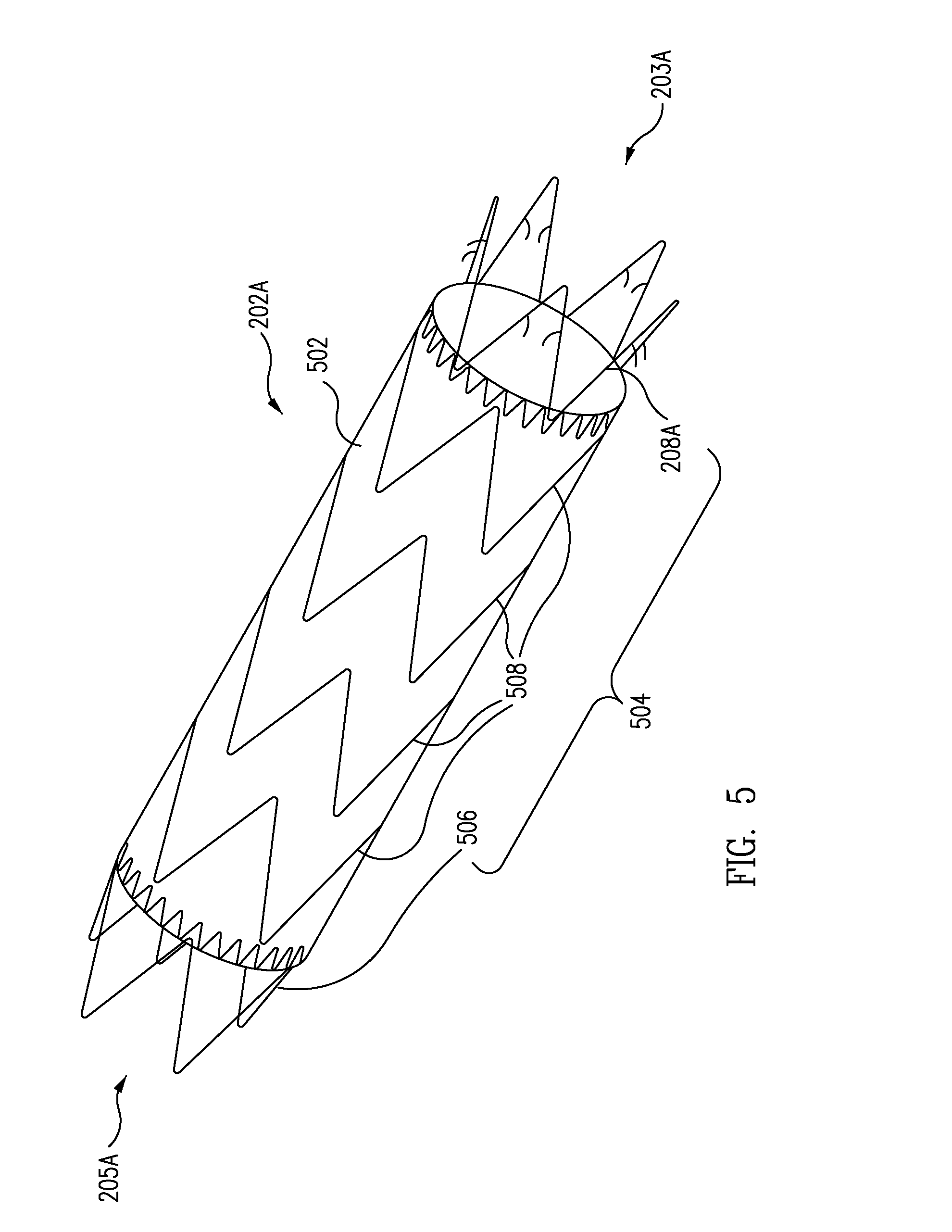 Delivery System for Stent-Graft With Anchoring Pins