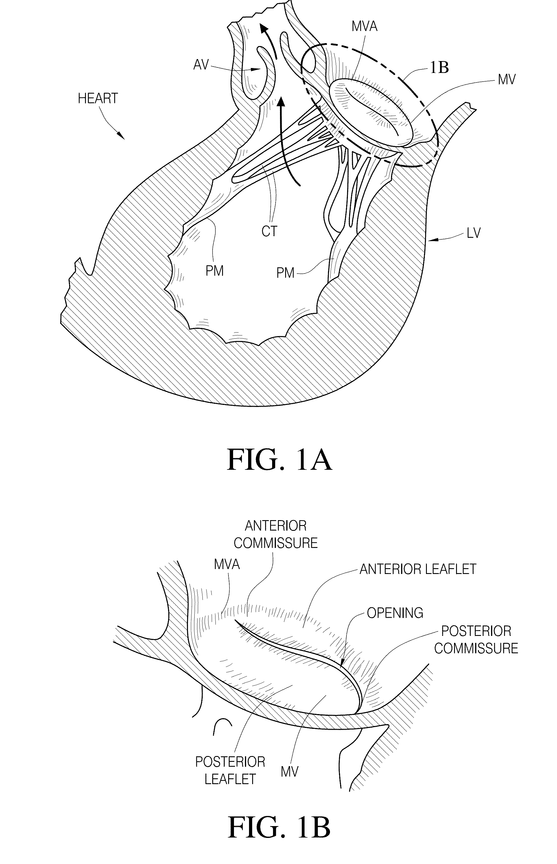 Valve replacement using rotational anchors