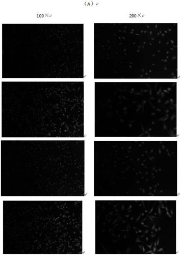 Humanized intestinal cancer precancerous lesion immortalized epithelial cell line and construction method and application thereof