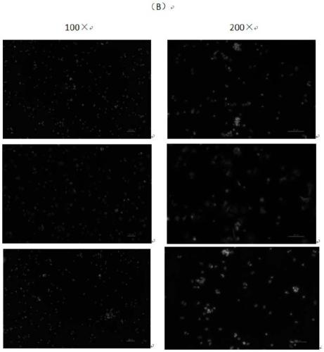 Humanized intestinal cancer precancerous lesion immortalized epithelial cell line and construction method and application thereof