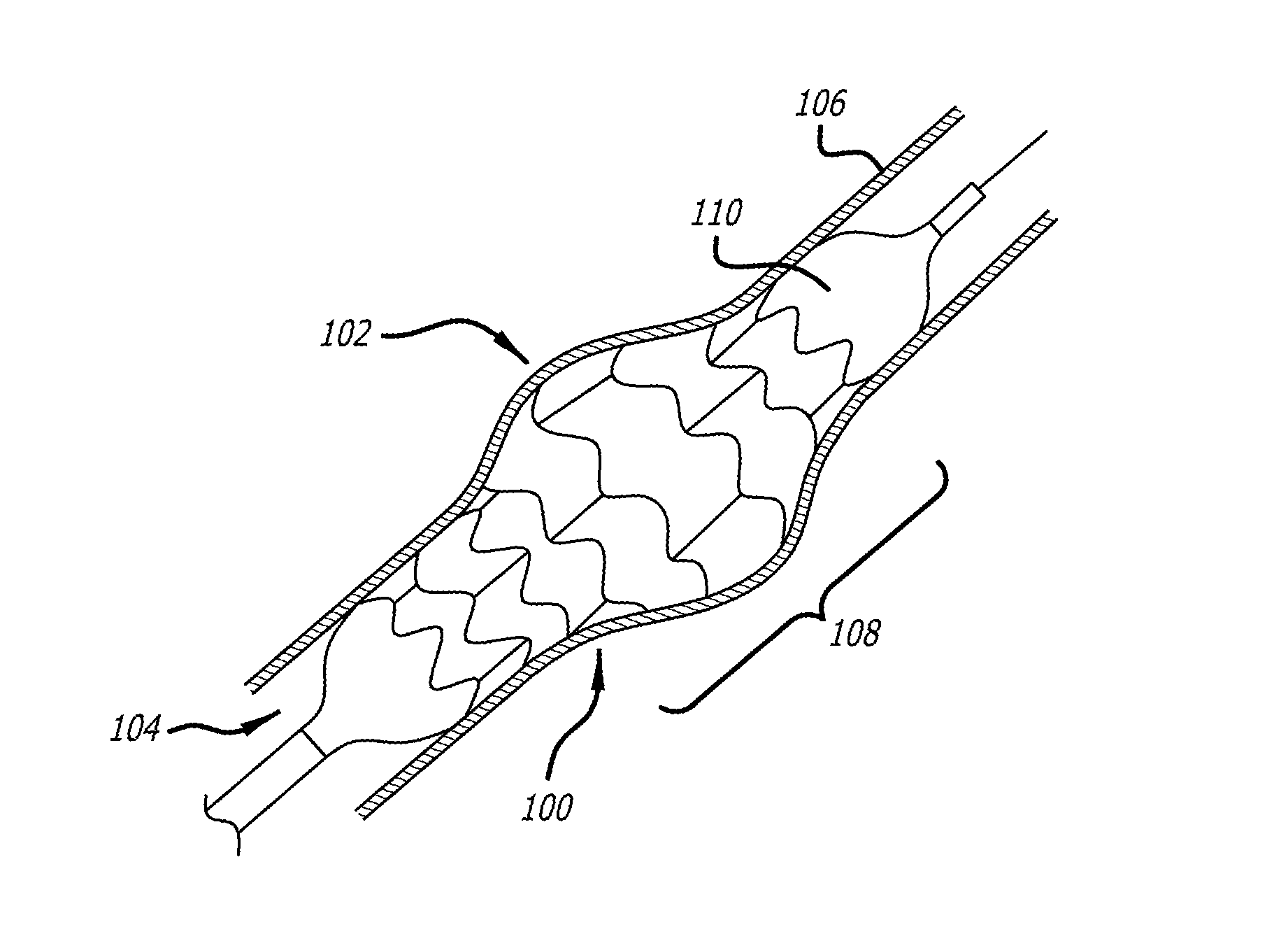 Method of delivering a medical device across a valve