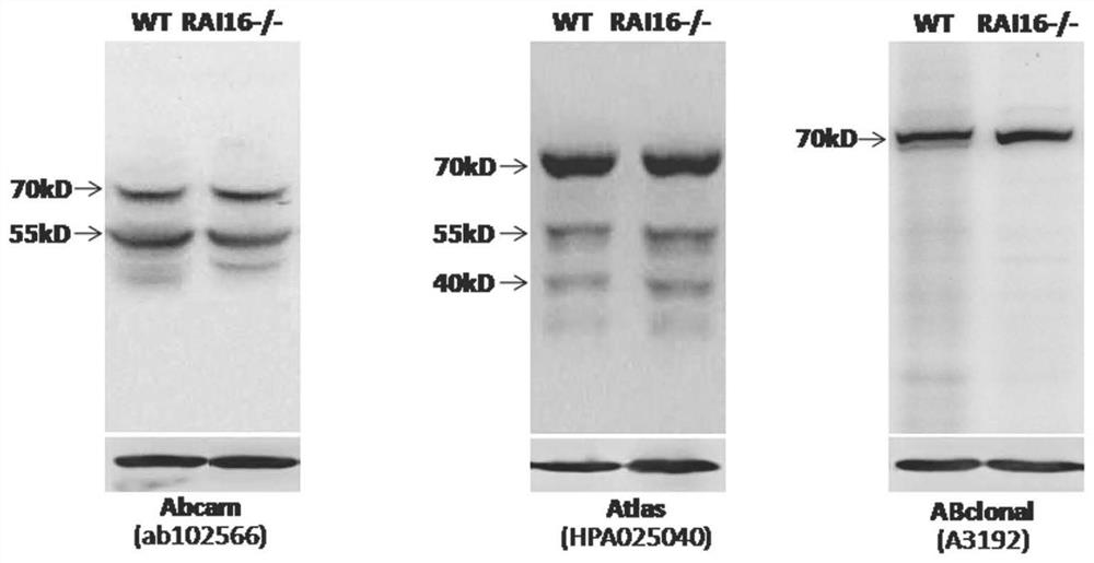 Preparation and application of retinoic acid induced protein 16 specific polyclonal antibody