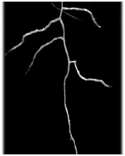 Method for preparing paeonia plant root tip chromosome slice