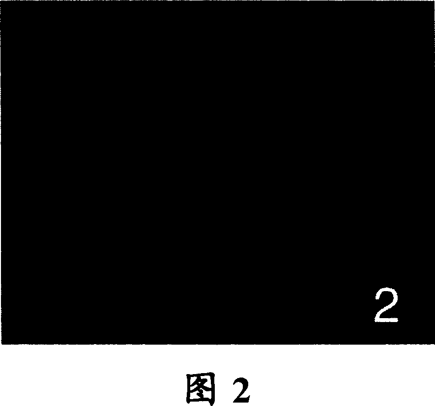 Method for cultivating human umbilical blood stem cell and directionally differentiating the same to dopaminergic nerve cell and application for the obtained dopaminergic nerve cell