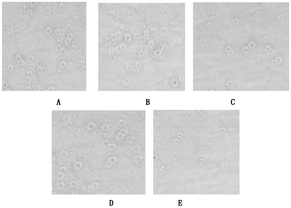 A dual inactivated vaccine for Mycoplasma ovine pneumonia and Chlamydia psittacosis and preparation method thereof