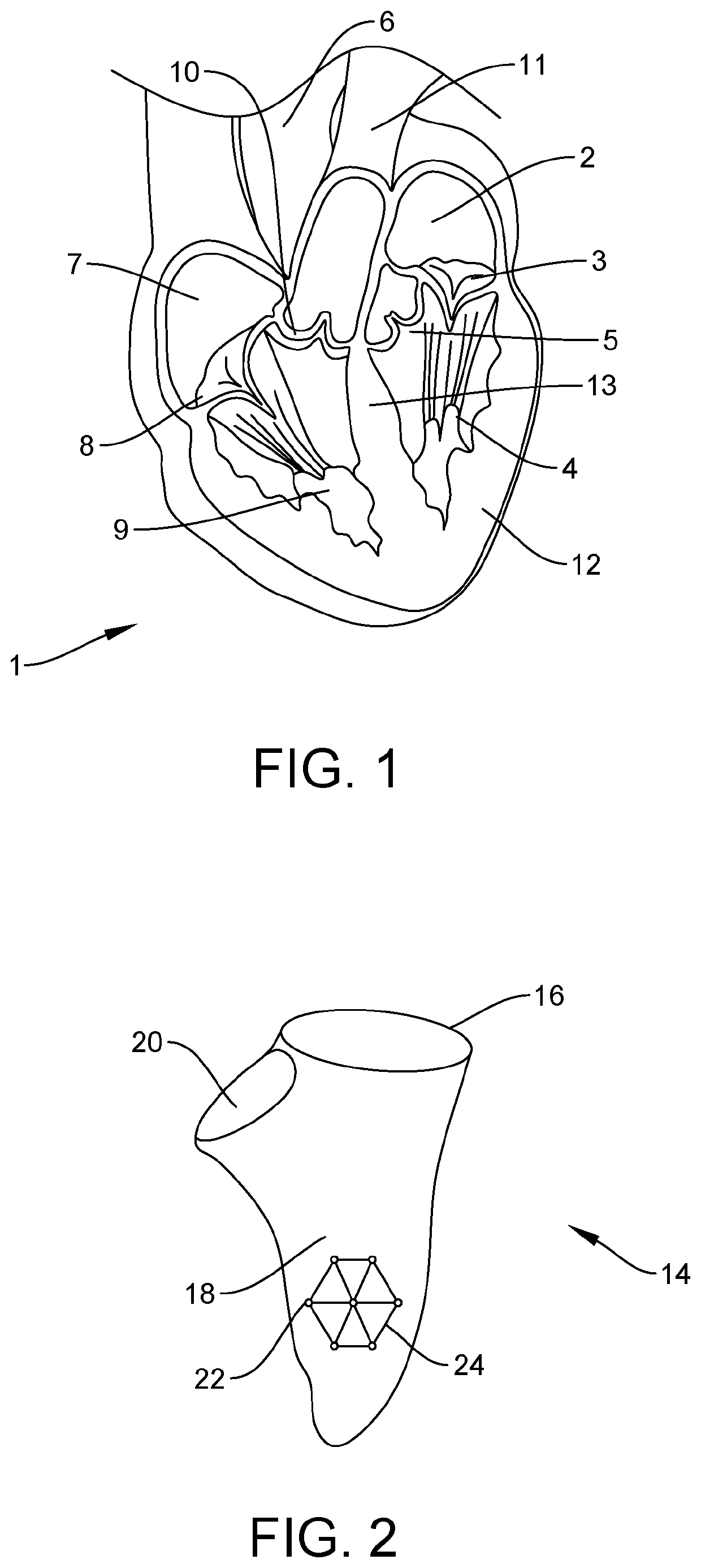 Method of visualizing a dynamic anatomical structure
