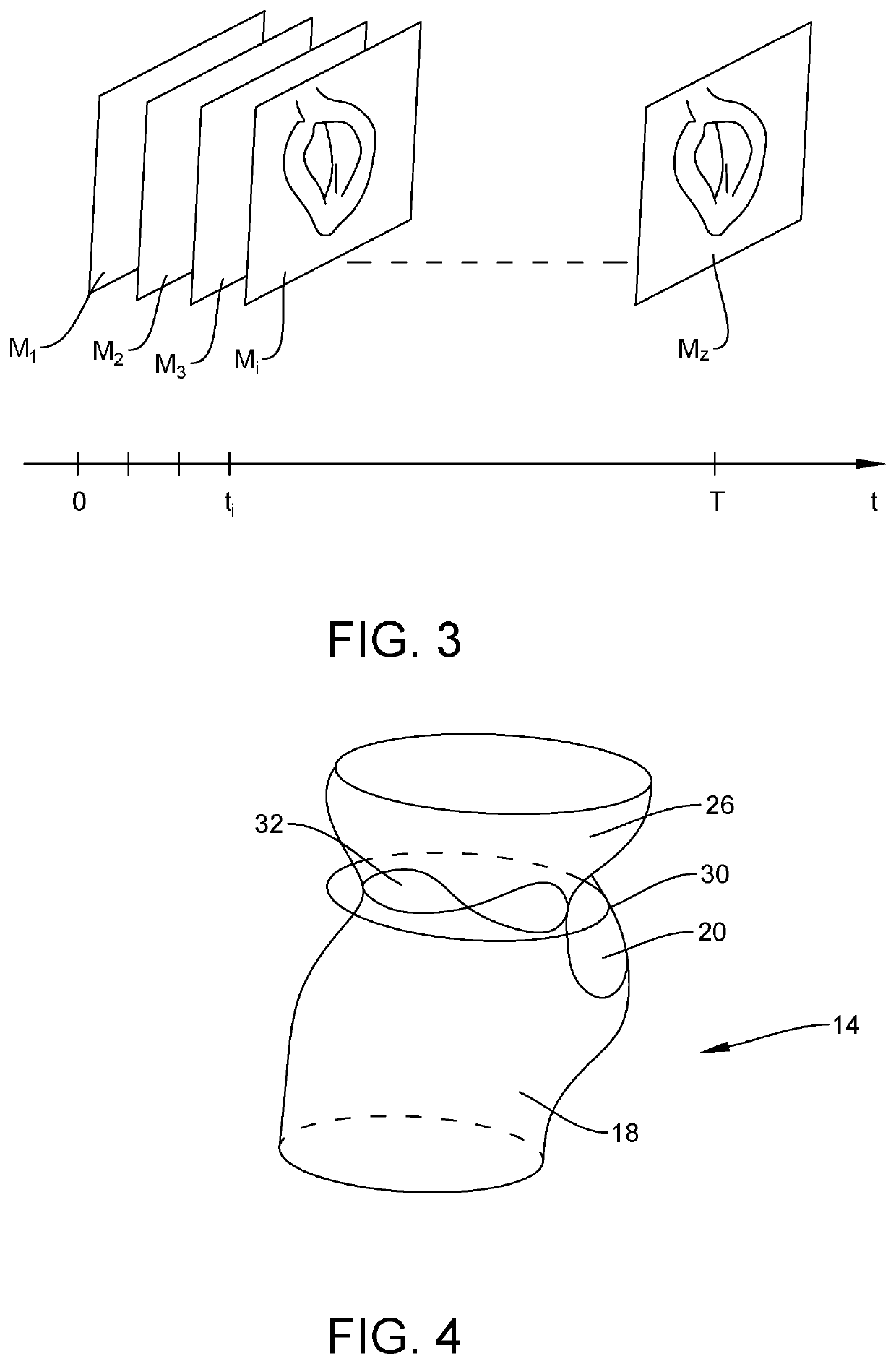 Method of visualizing a dynamic anatomical structure