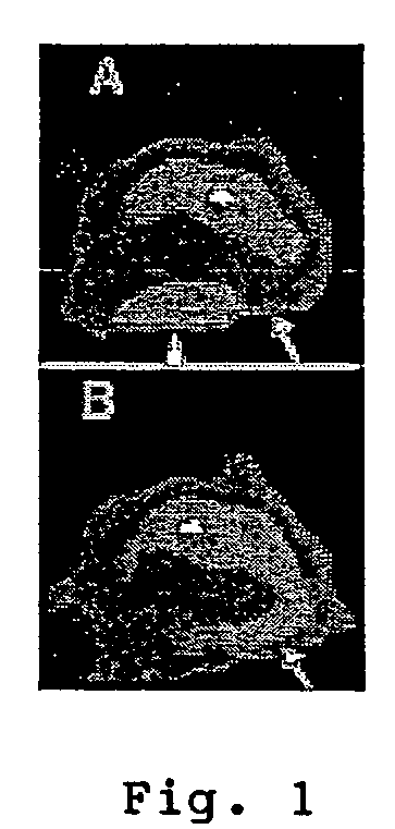 Enhanced cardiac radionuclide imaging techniques