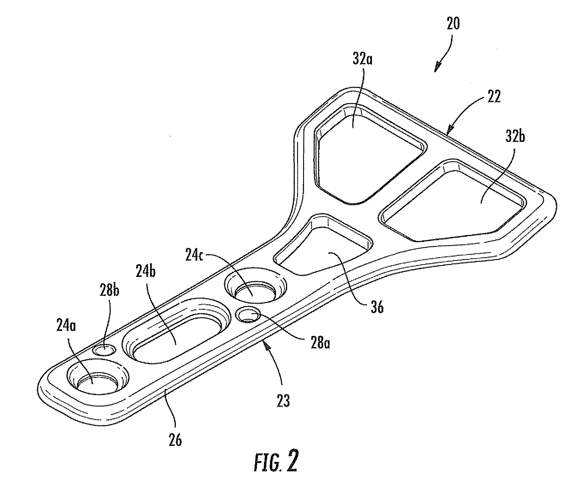 Modular bone fixation device for treatment of fractures and related methods