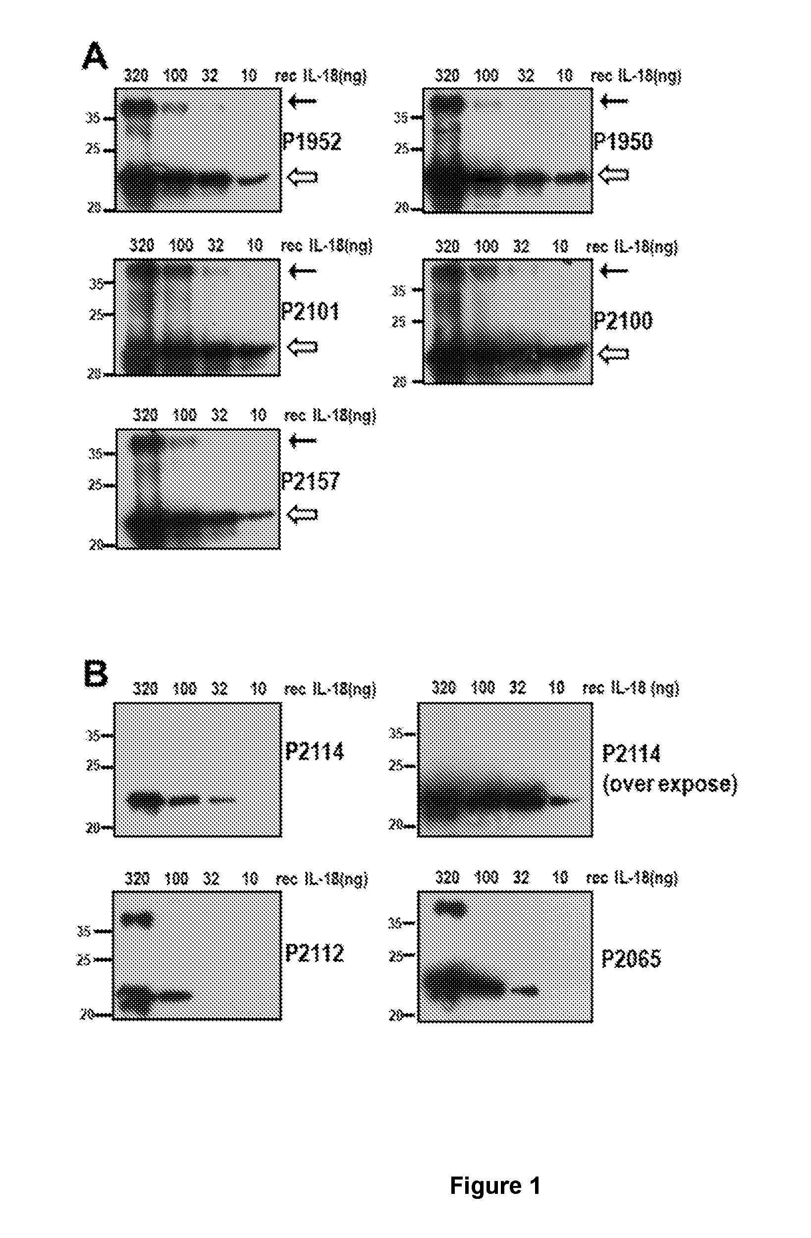 Diagnosis of cancer by detecting dimeric il-18