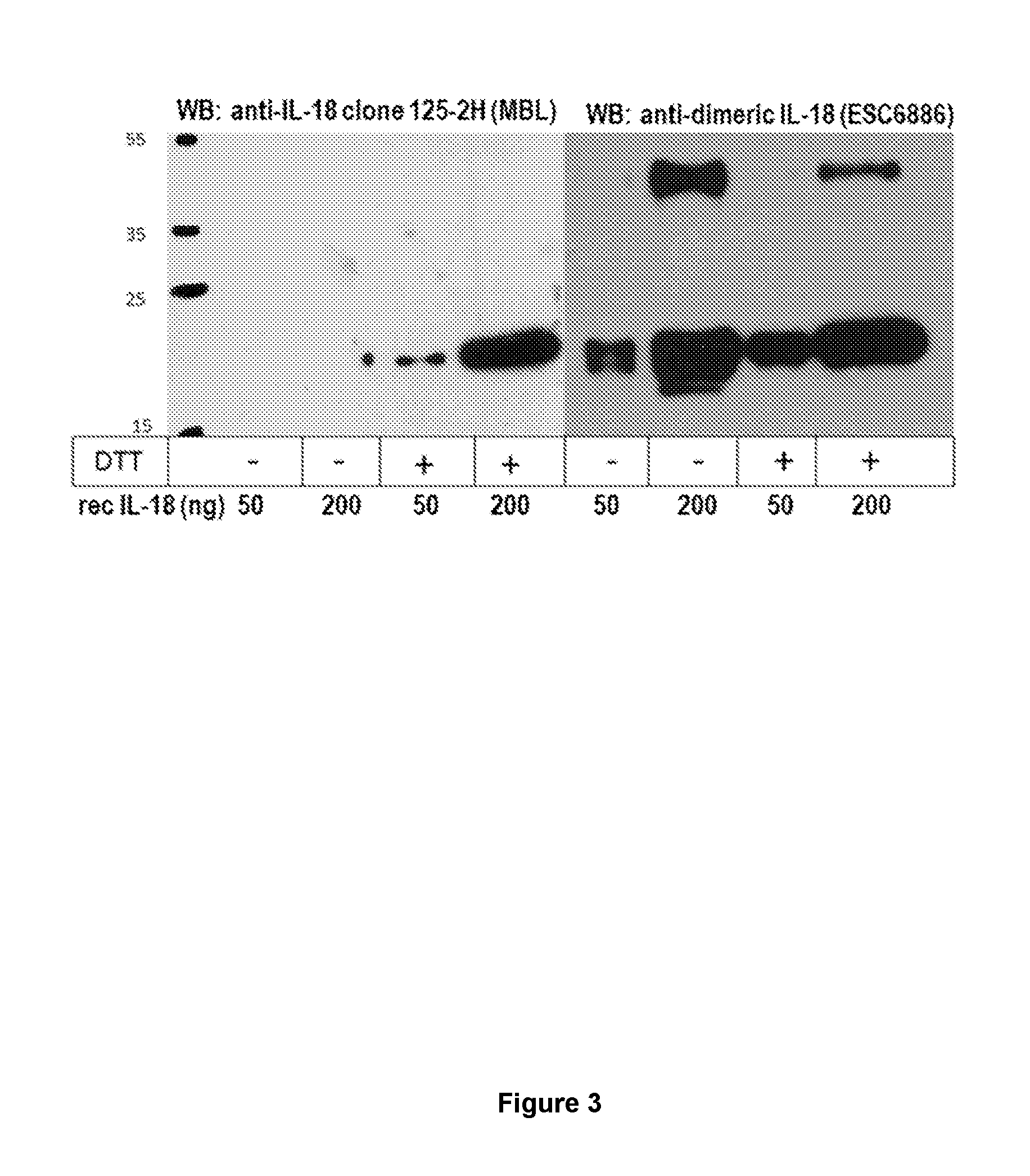 Diagnosis of cancer by detecting dimeric il-18