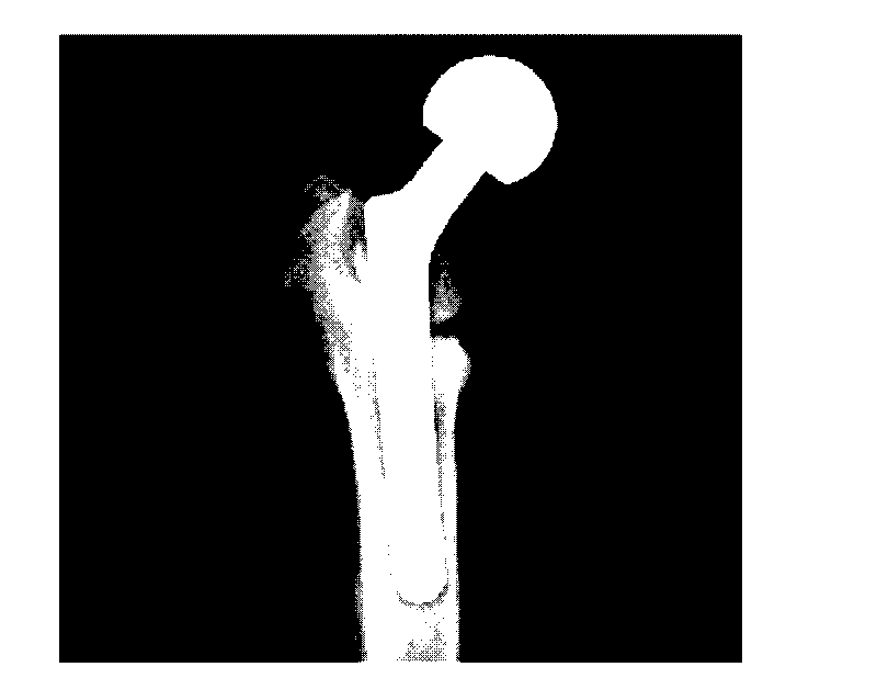 Method for strengthening joint stability by using rhBMP-2 release coating on surface of artificial joint