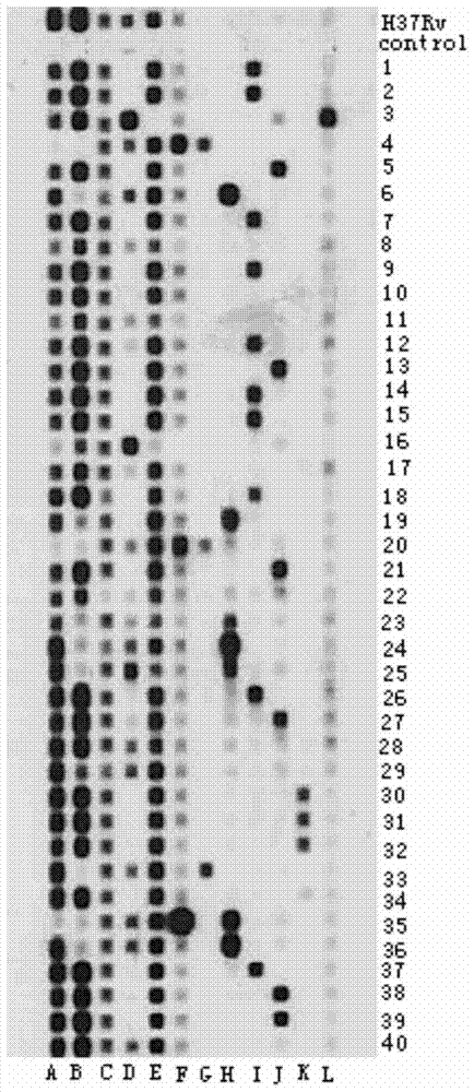 A combination of four first-line drug resistance gene specific fragments of Mycobacterium tuberculosis and its application