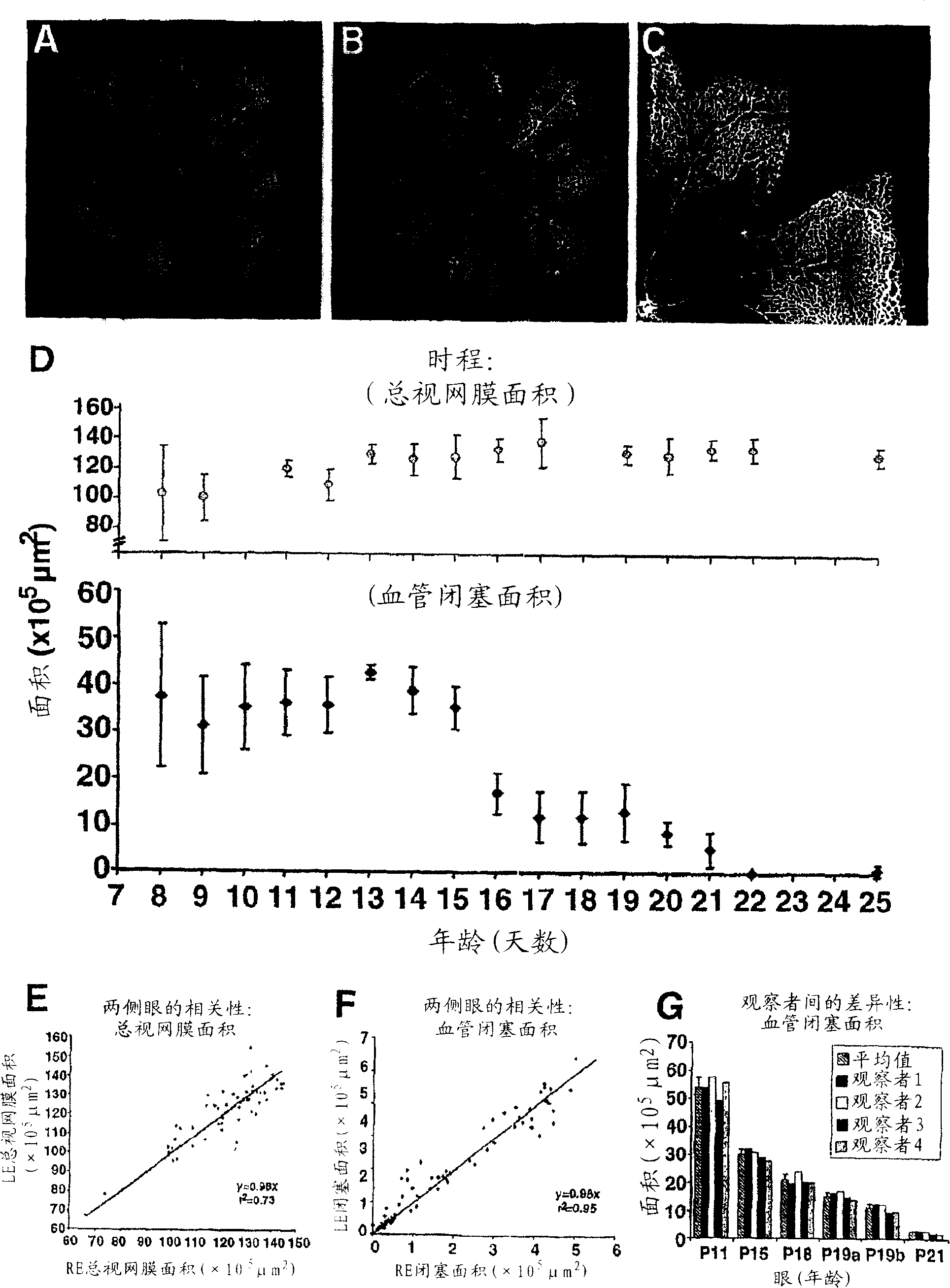 Revascularization of ischemic retinal tissue and screening method therefor