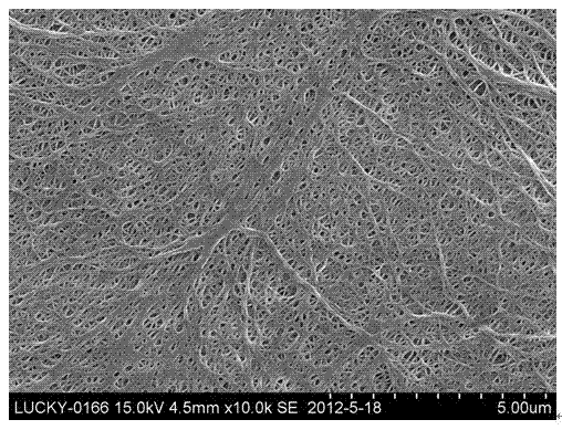 Method for preparation of polyolefin microporous membrane by wet process