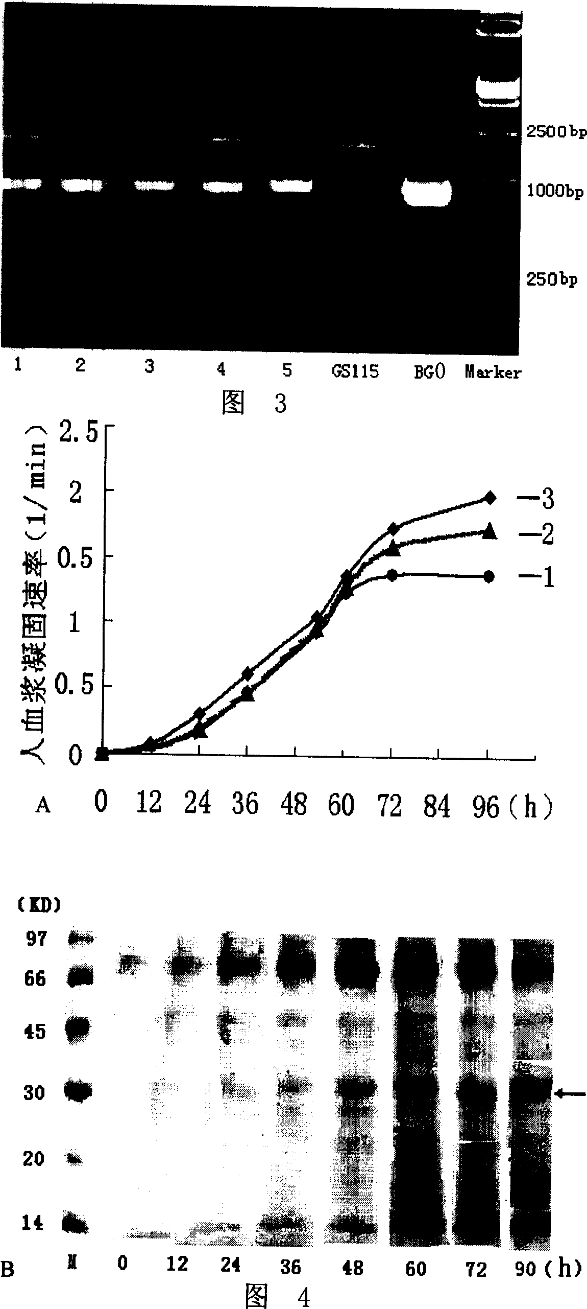 Batroxobin and its preparing process and specific coding gene