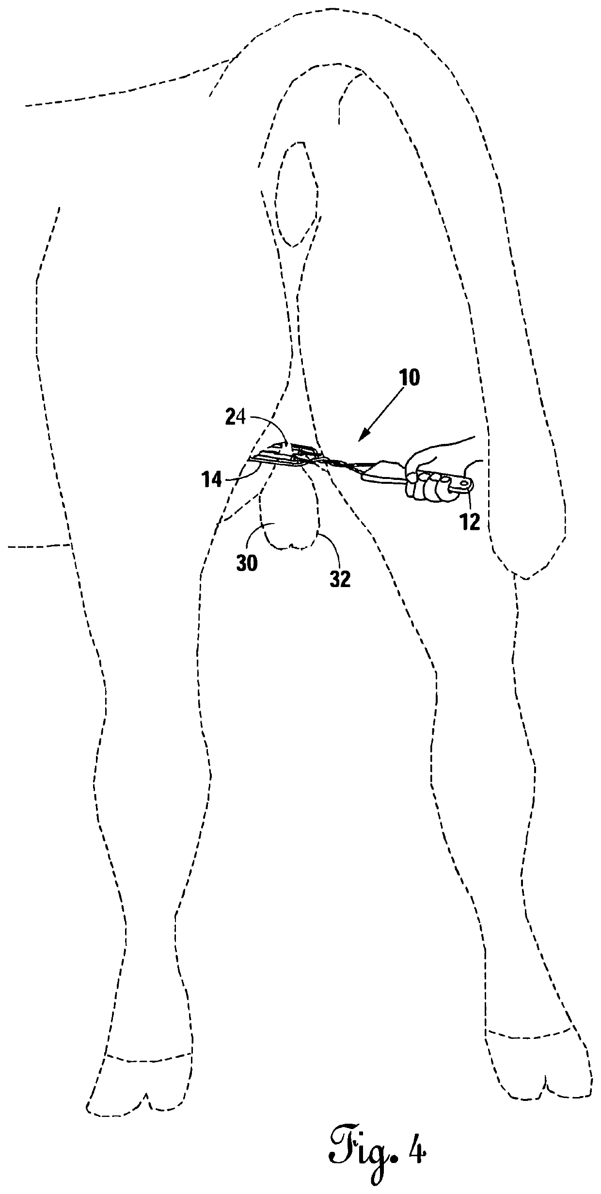 Device and method for mitigating the ascension of testicles during castration of livestock