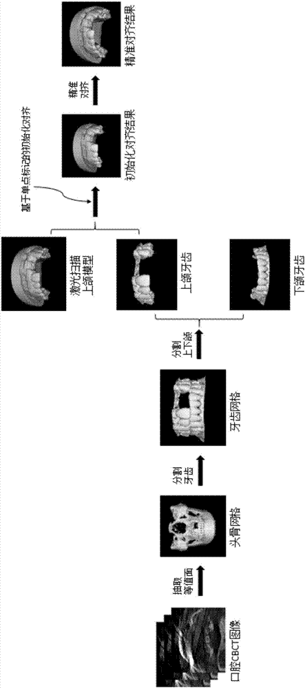 Data fusion method for oral CBCT image and laser scanning tooth grids