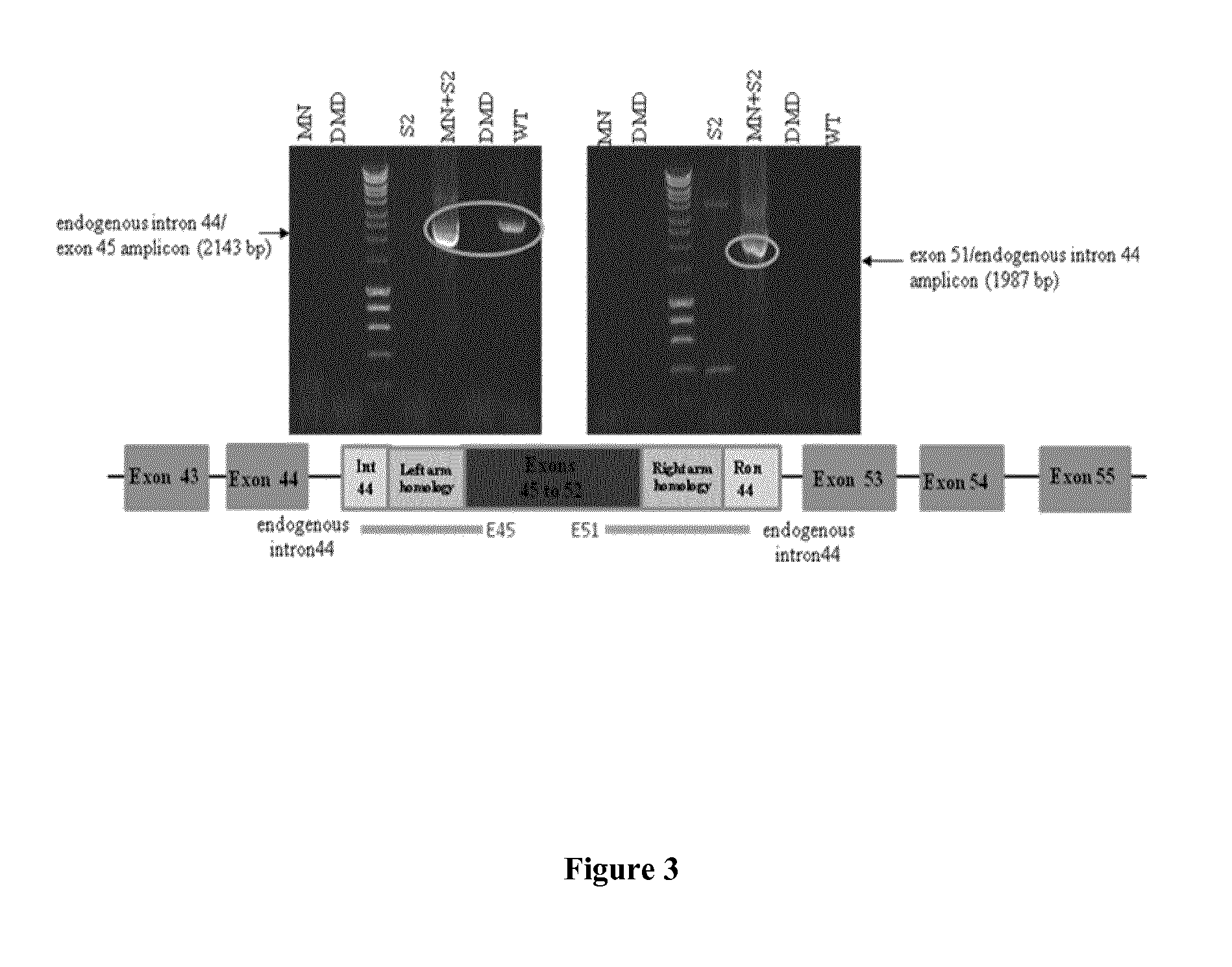Compositions and methods for duchenne muscular dystrophy gene therapy