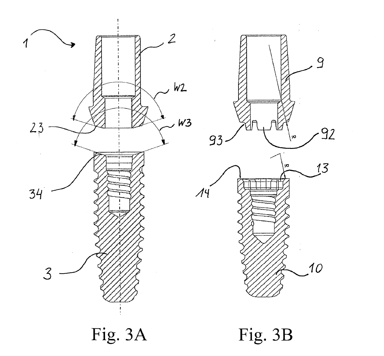 Dental prosthesis system