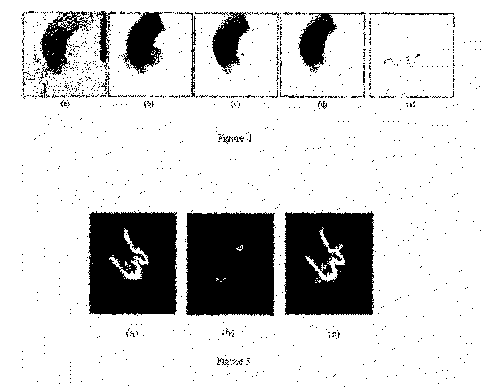 System and method for 2-d/3-d registration between 3-d volume and 2-d angiography