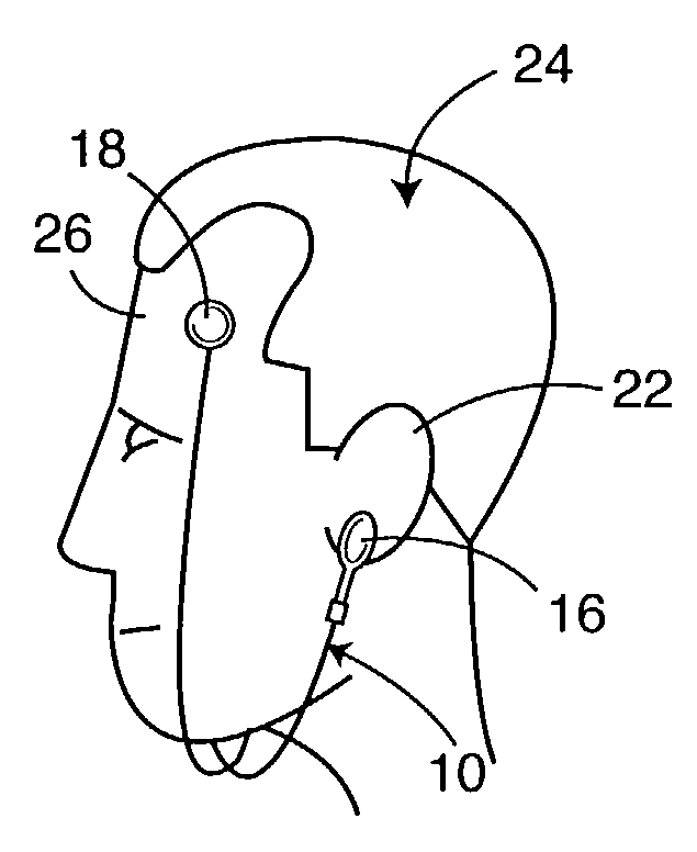 Method and apparatus to modify cranial electrical potentials to remediate psychiatric disorders and to enhance optimal brain functioning