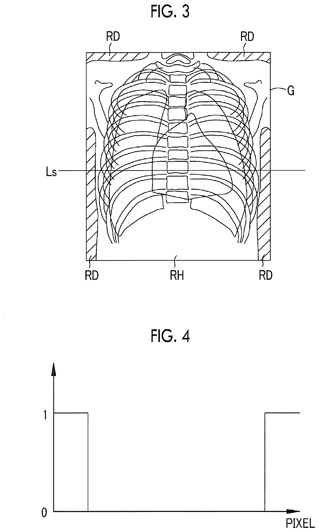 Radiographic image processing device, method of operating radiographic image processing device, and radiographic image processing program
