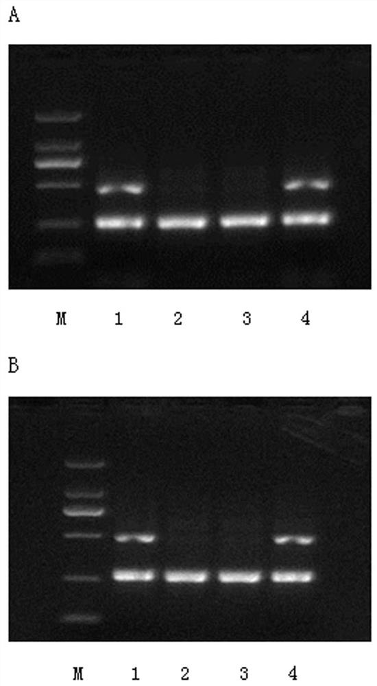 Para-bombay phenotype FUT1 508dupT allele as well as detection method and application thereof