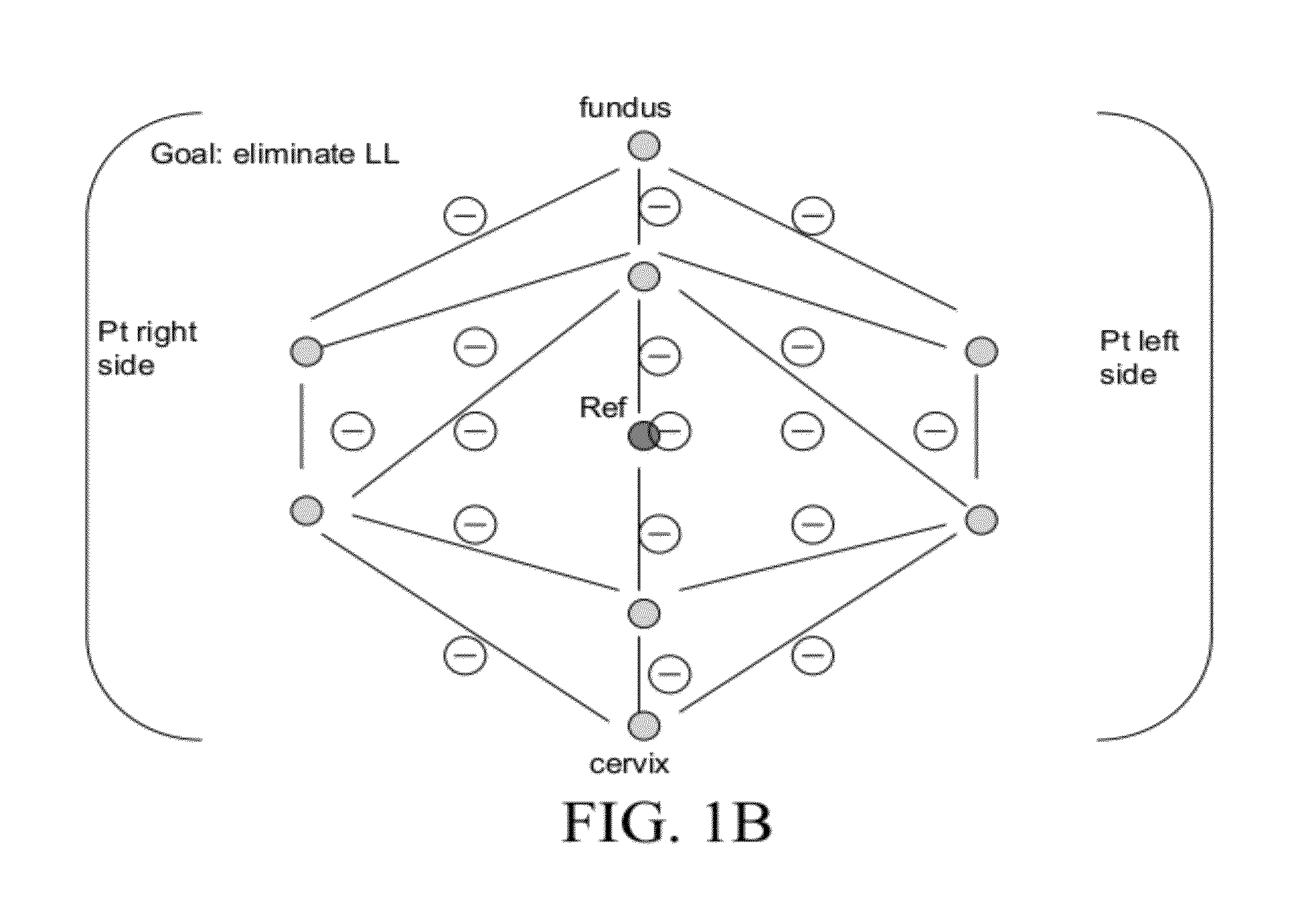 System and Method for Analyzing Progress of Labor and Preterm Labor