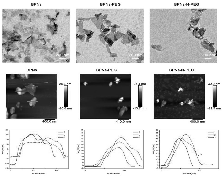 Preparation of oral black phosphorus nano material and application of oral black phosphorus nano material in gastrointestinal diseases