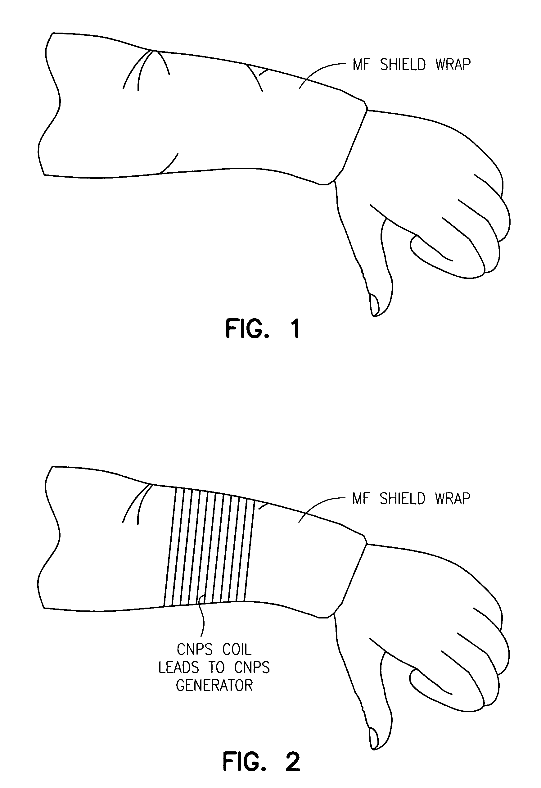 Device for magnetic and electric field shielding