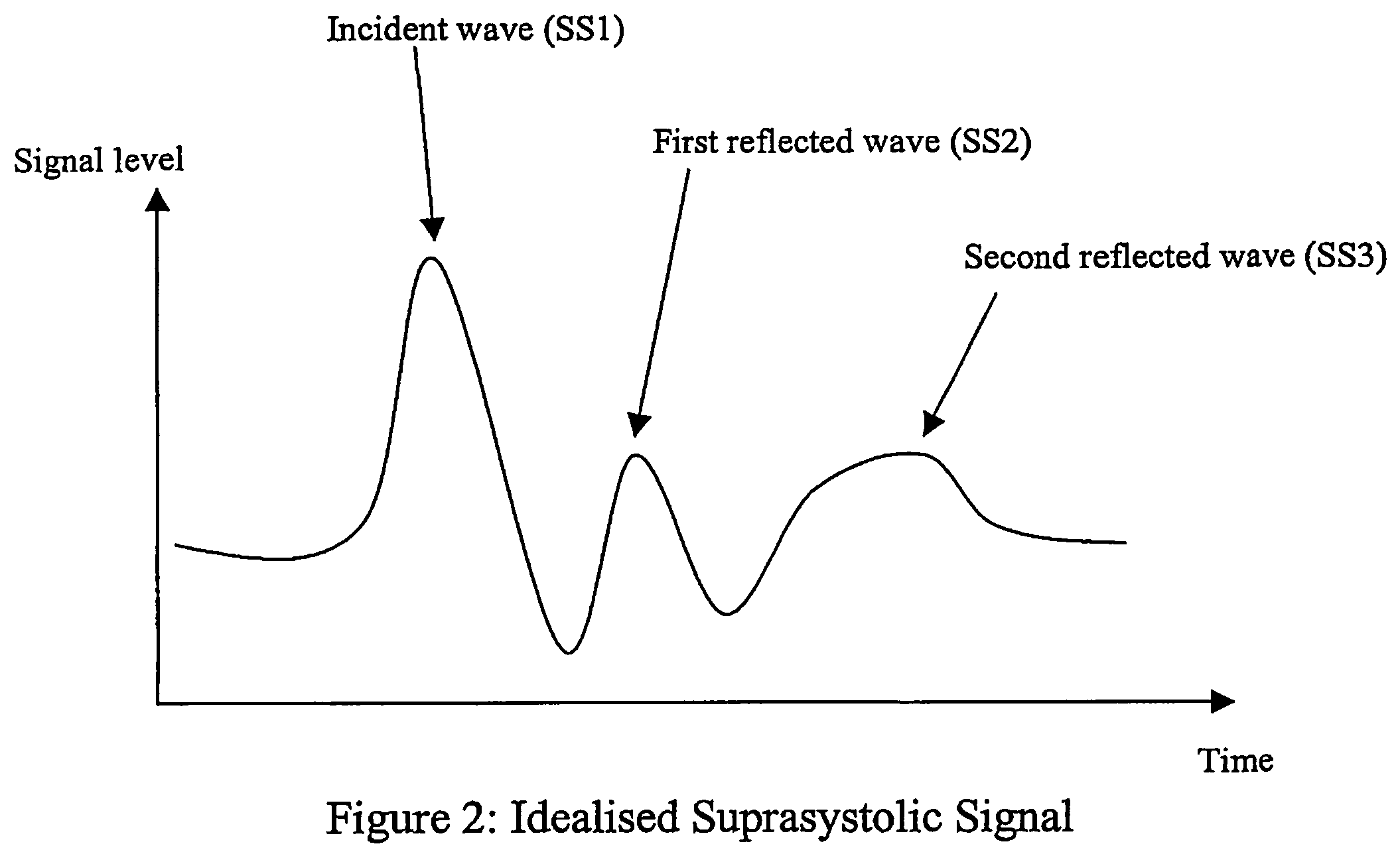 Non-invasive measurement of suprasystolic signals