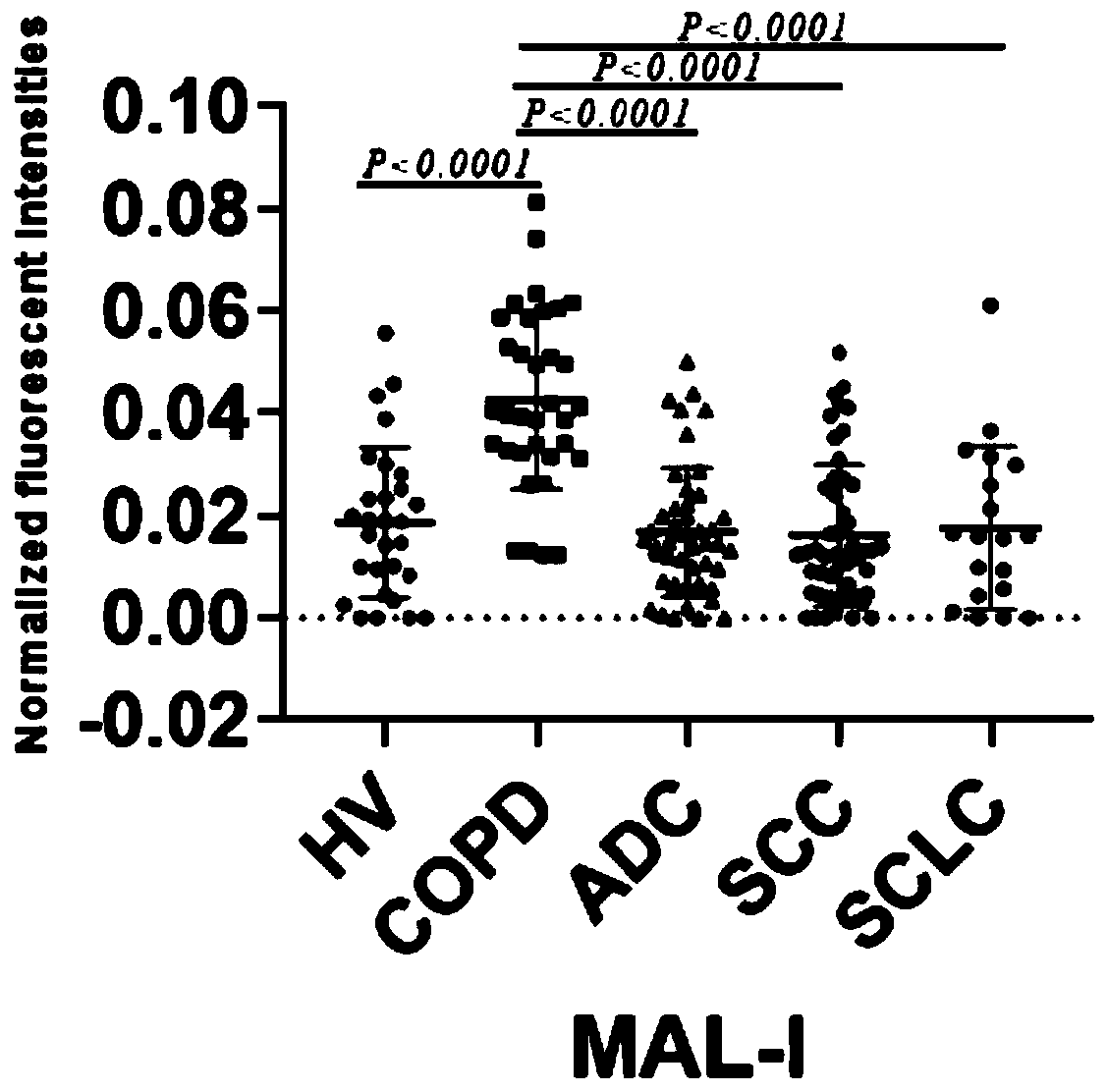 Product for screening and evaluating benign lung diseases based on saliva specific glycoprotein sugar chain structure and application