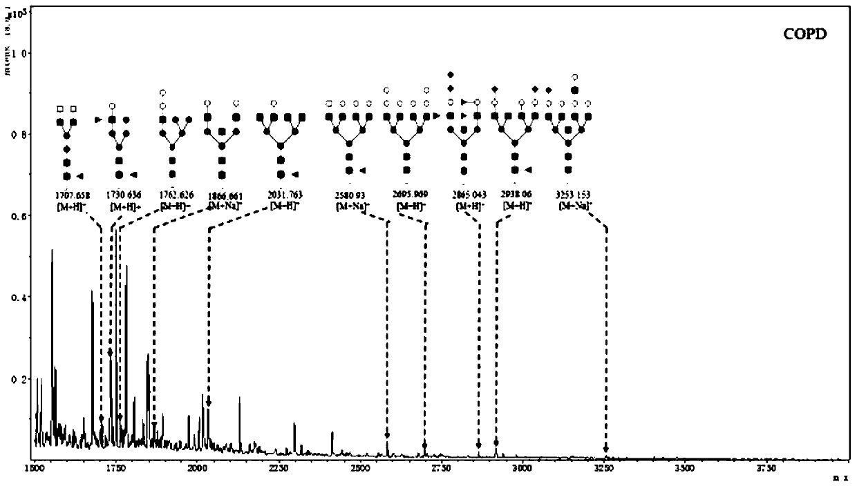 Product for screening and evaluating benign lung diseases based on saliva specific glycoprotein sugar chain structure and application