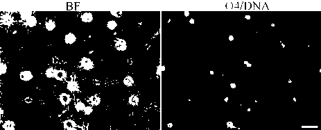 siRNA and recombinant vector for restraining MAG gene expression