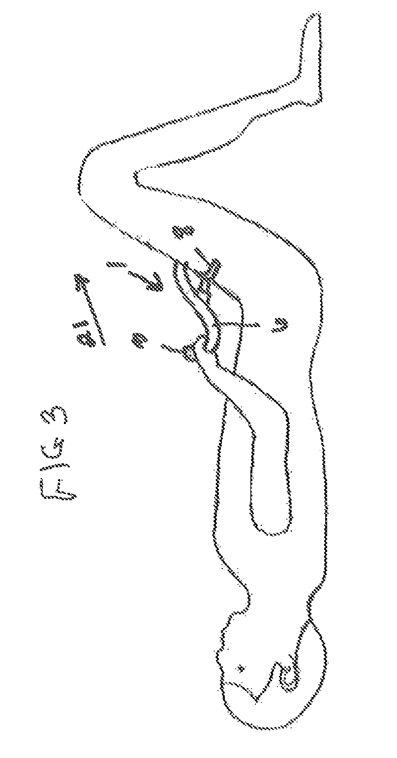 Simple portable lumbar spine distraction device and method