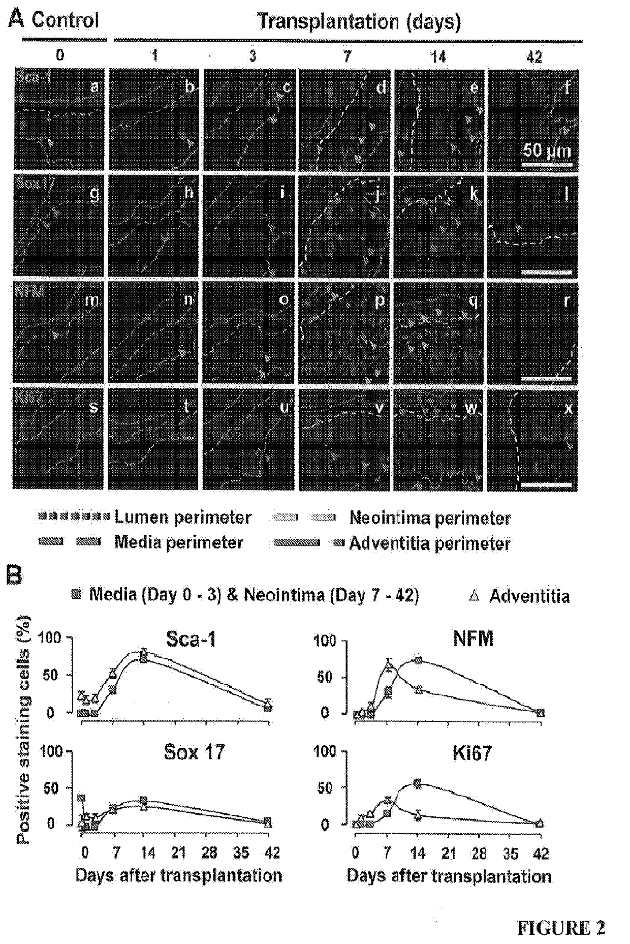 Suppression of neointimal formation following vascular surgeru using cdk8 inhibitors