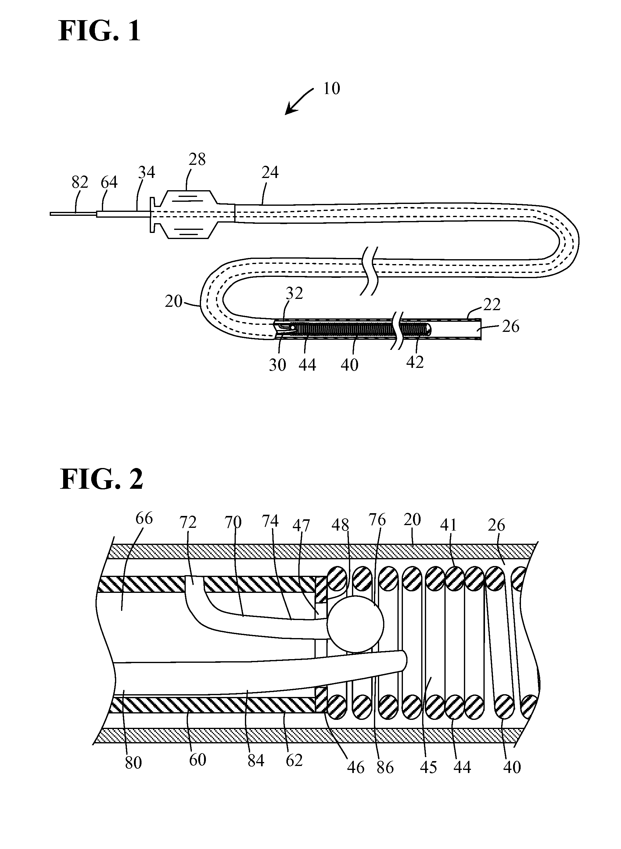 Detachable Coil Release System and Handle System
