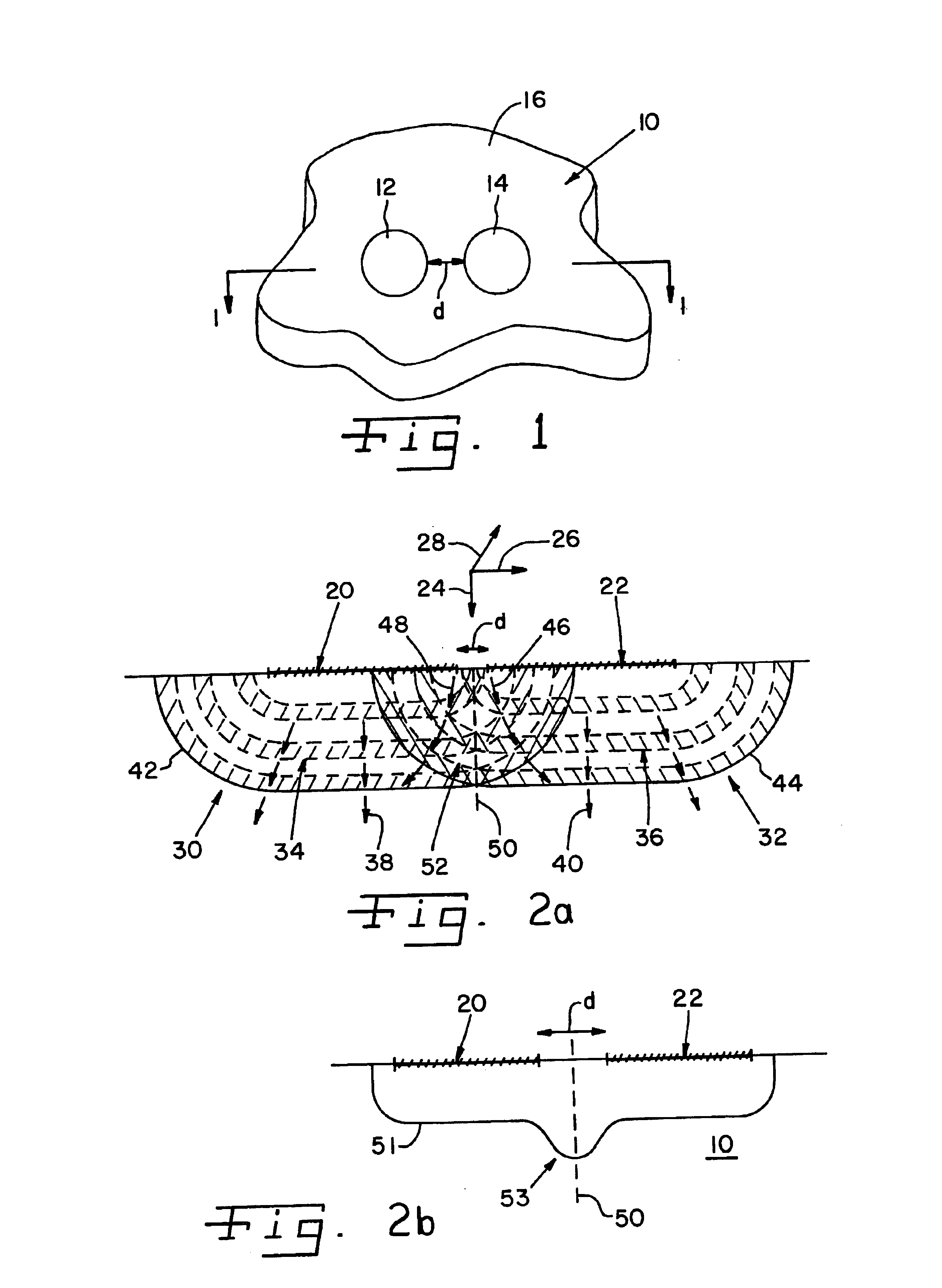Method using laser shock processing to provide improved residual stress profile characteristics